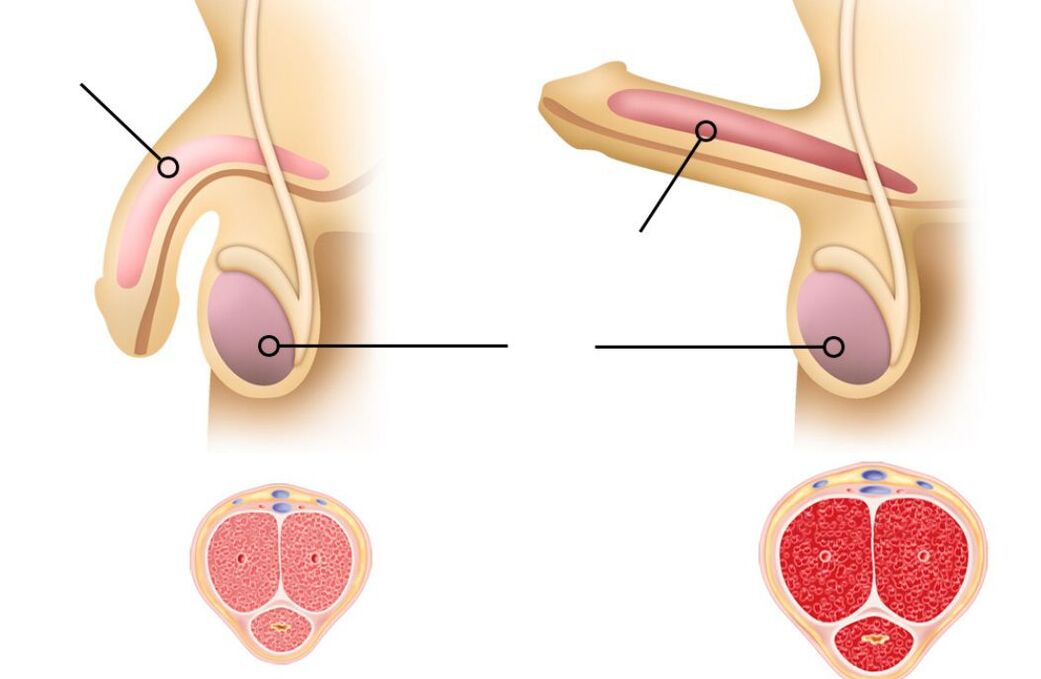 cause of decreased potency in men